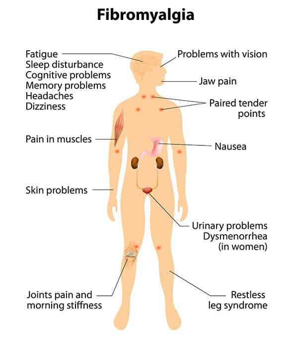 What is Fibromyalgia Disease and What are The Symptoms?