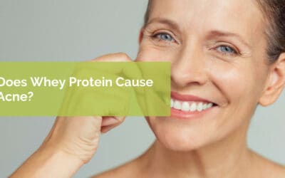 Does Whey Protein Cause Acne?